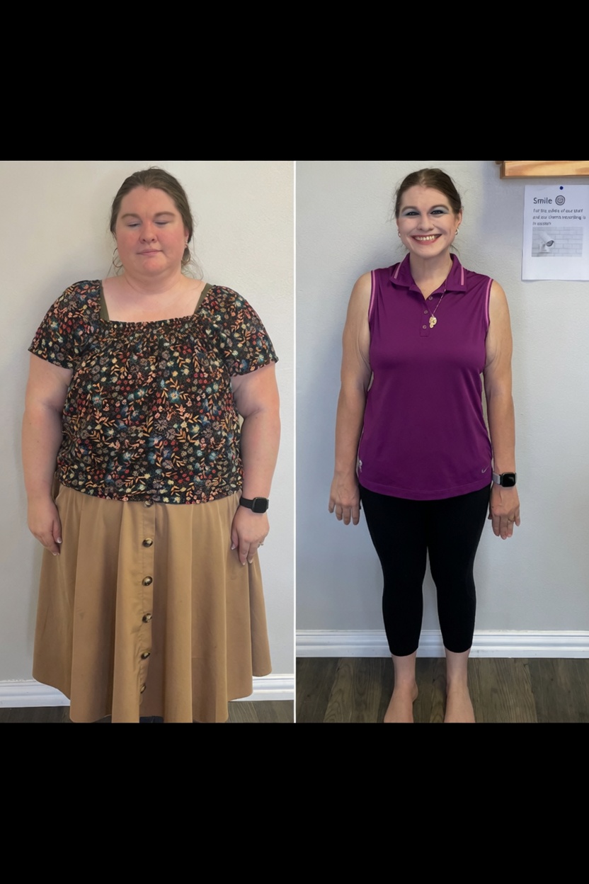 Emily lost 141 pounds with Millstone Medical weight loss program Greenville SC